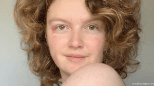 Kelsey Waghorn: White Island volcano survivor’s gruesome injuries revealed – as she relives the moment the world erupted in a deadly fireball, killing 22 around her and maiming 25 more