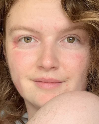 Kelsey Waghorn: White Island volcano survivor’s gruesome injuries revealed – as she relives the moment the world erupted in a deadly fireball, killing 22 around her and maiming 25 more